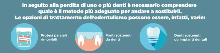 alternative impianto dentale