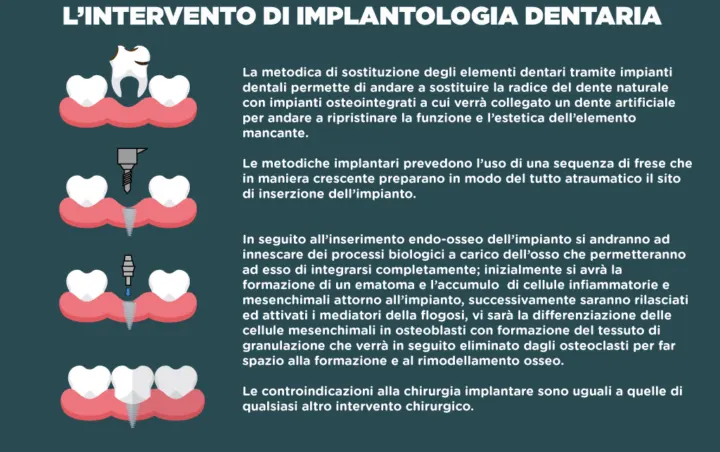 intervento impianti dentali caltanissetta
