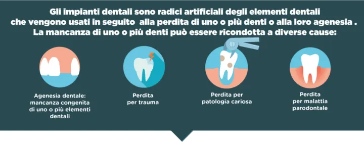 quando è necessaria l'implantologia dentale