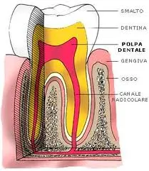 endodonzia caltanissetta